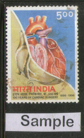 India 1996 Cardiac Surgery Phila-1477 Used Stamp